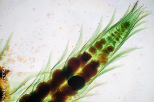 Moss gametophyte is the sexual phase in the life cycle of plants under microscope. photo