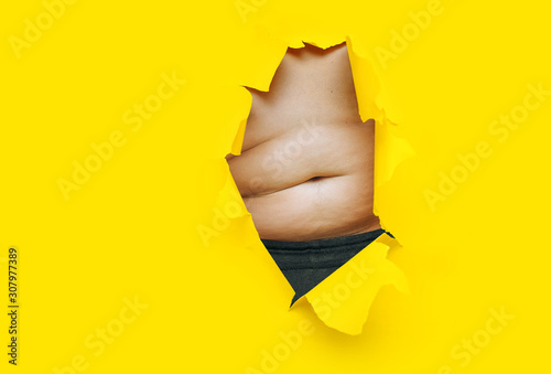 Male fat, flabby stomach in a torn aperture of yellow paper. The concept of beer belly, gluttony and cellulite. Copy space. photo