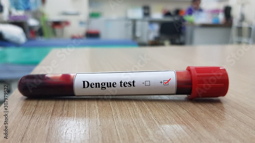 Positive Dengue test and laboratory sample of blood testing for diagnosis Dengue virus infection with blurred hospital background. Tropical infectious disease and Diagnostic technology concept.
