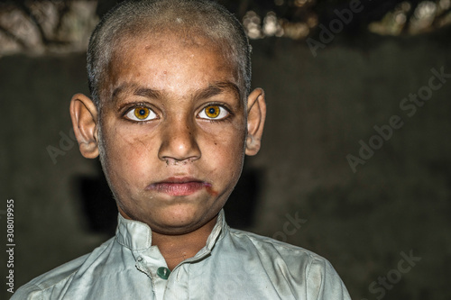 a poor crying staring hungry orphan boy in a refugee camp with sad expression on his face and his face and clothes are dirty and his eyes are full of pain