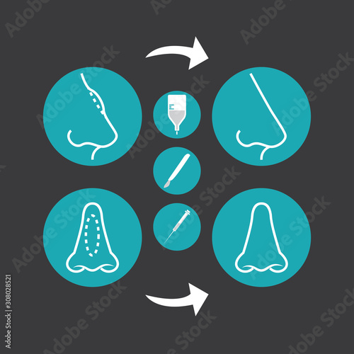 Rhinoplasty plastic surgery nose job