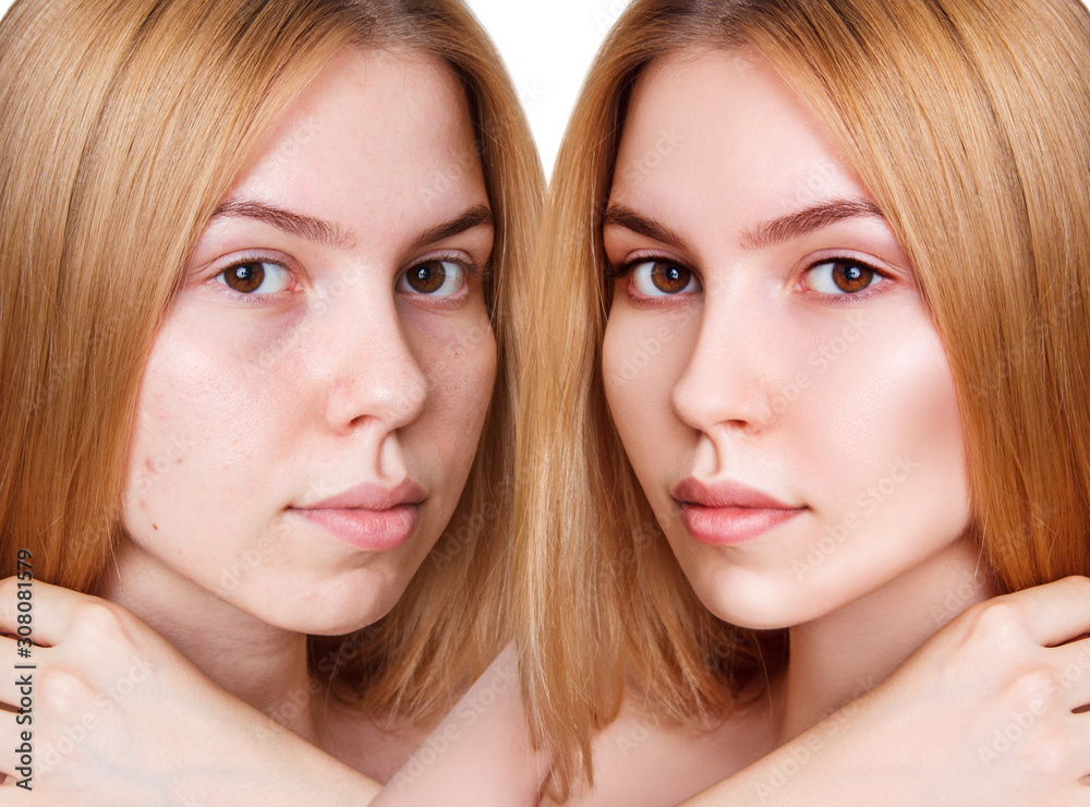 Face of beautiful woman before and after make-up. Face of beautiful woman before and after make-up.