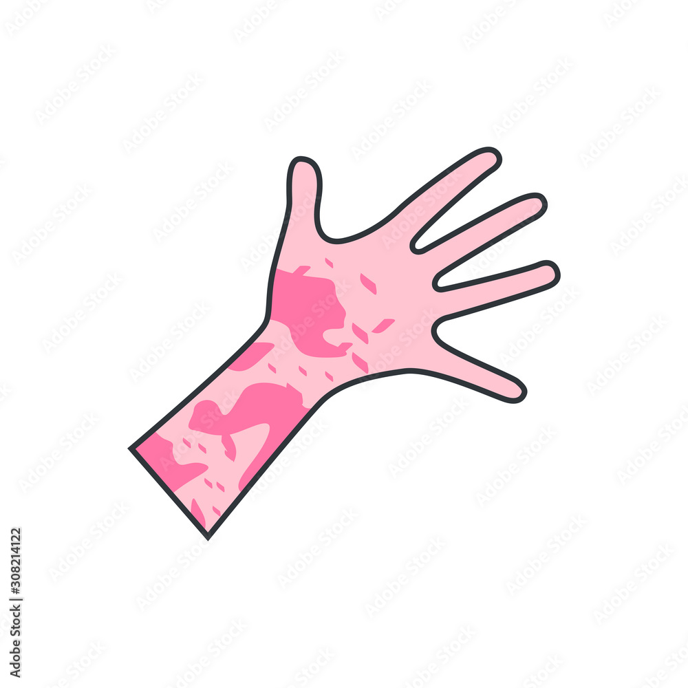 Obraz premium Skin rash, insect bites allergy reaction. irritation on hand. vector illustration
