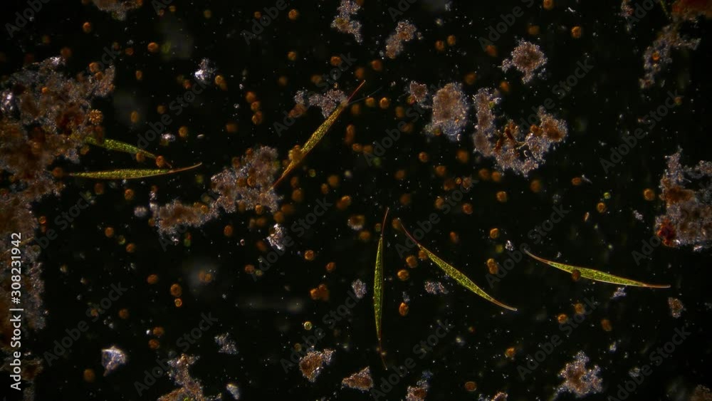 microorganism in pond water under microscope unicellular organisms ...