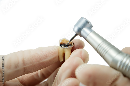 dental handpiece drills a tooth isolated on a white background, the treatment of carious tooth, the training of dentists photo