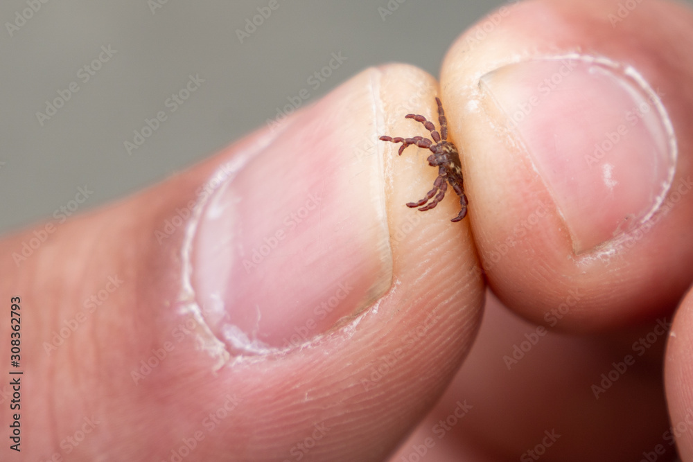 Picking dog tick pinched with fingers by person close up.