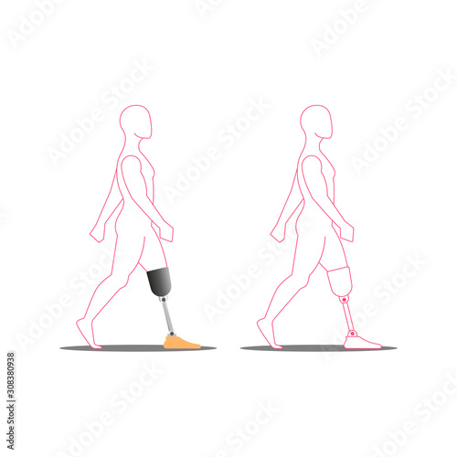 Disabled person with prosthetic leg medical vector illustration, silhouette of a walking invalid.
