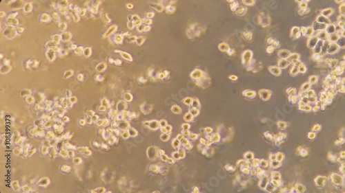 yeast under a microscope floating in liquid photo