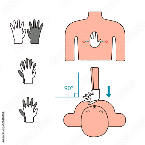 CPR_Chest compression
