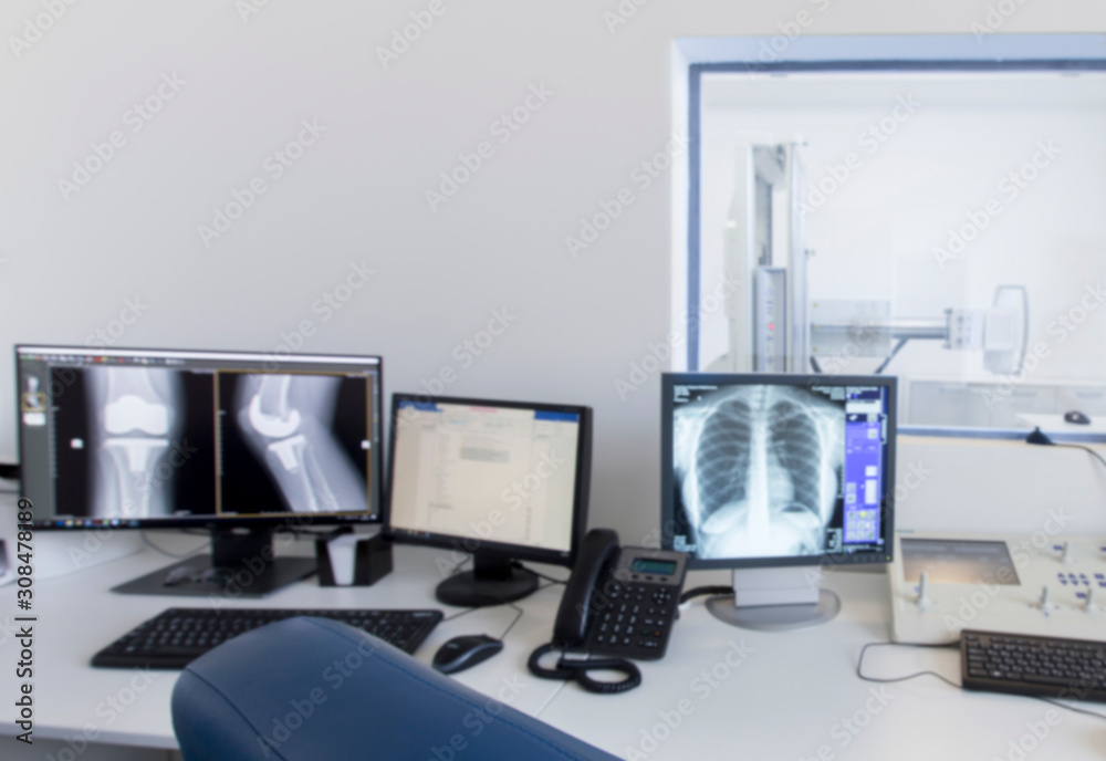 Monitor with X-ray of human body parts in modern laboratory Monitor with X-ray of human body parts in modern laboratory