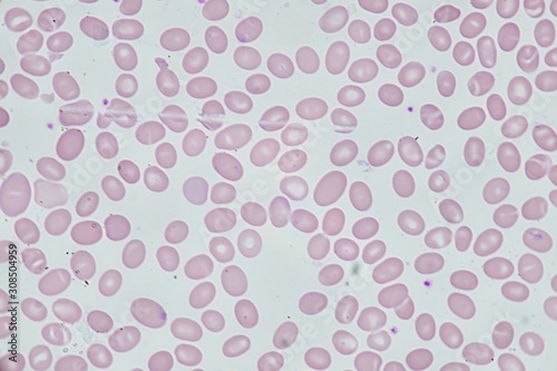 Wallpaper Mural Abnormal red blood cell Torontodigital.ca