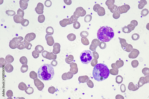 White blood cells (Neutrophil , Monocyte and Eosinophil) photo