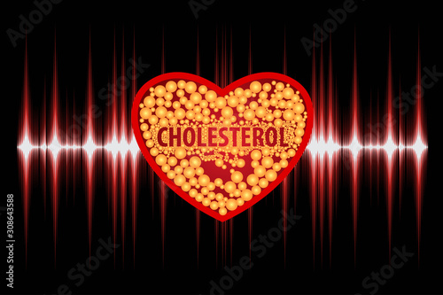 Cholesterol in artery, health risk , vector design