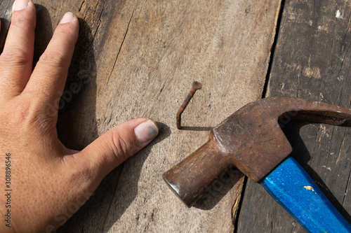 bent nail, hammer and thumb injury