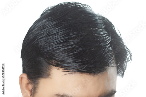 Young Asian men worry about problem hair loss,head bald,dandruff.hair loss problem and Hair treatment concept
