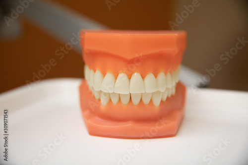 model of teeth show correct spacing of front teeth