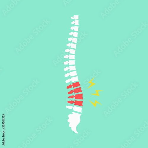 Backache. Back pain vector icon illustration isolated on blue background. Damaged Dorsal Disks