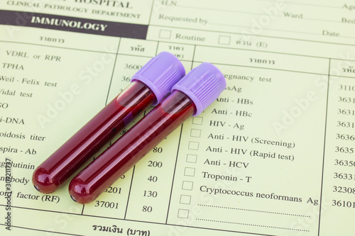 Blood in test tubes and investigation form.
