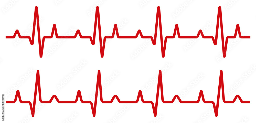Heartbeat line set. EKG. Vector illustration