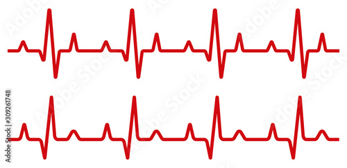 Heartbeat line set. EKG. Vector illustration