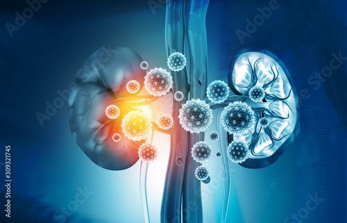 Foto Kidney disease concept. 3d illustration.
