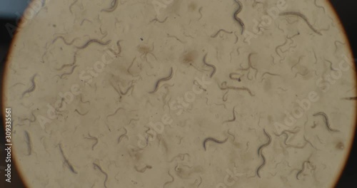 A colony of microorganisms, c-elegans (Caenorhabditis elegans) nematode worms under the microscope, moving in a petri dish, macro shot. BMPCC 4K. Biochemistry, pharmaceutical medicine,science   photo