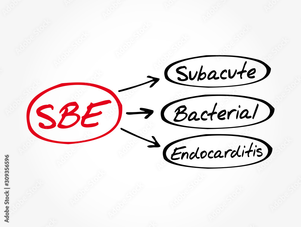 SBE - Subacute Bacterial Endocarditis acronym, medical concept background  Stock Vector | Adobe Stock
