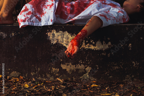 Quadro su tela Murdered women's hand lying on the ground in the middle of the forest