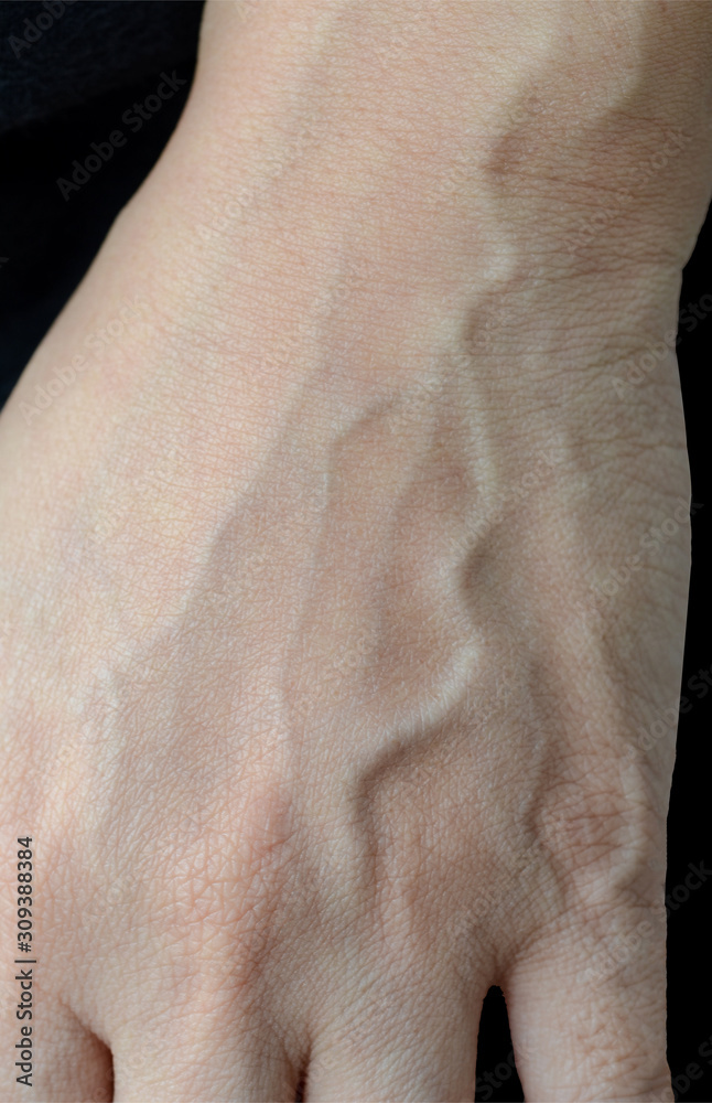 blood veins on black background. blood veins on black background.