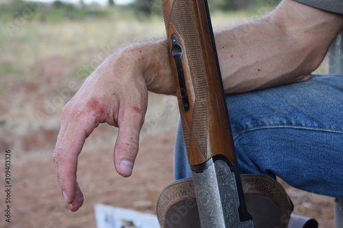 Man Hands with Blood and Gun