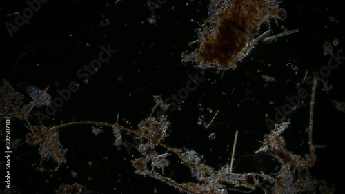 microorganism in pond water under microscope unicellular organisms