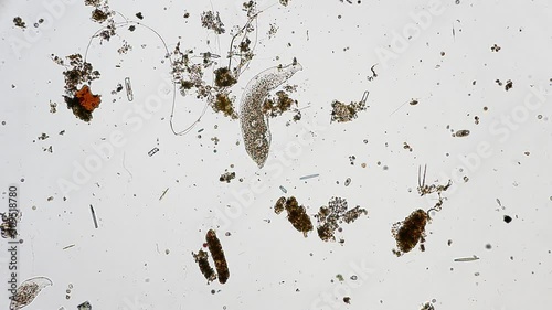 microorganism in pond water under microscope unicellular organisms