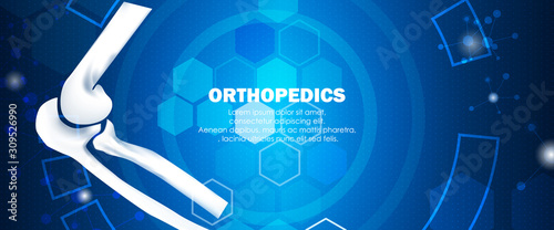 Medical orthopedic and the future of the smart hospital. Treatment for orthopedics traumatology of elbow bones, and joints injury. Medical presentation, hospital. Vector illustration