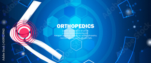 Medical orthopedic and the future of the smart hospital. Treatment for orthopedics traumatology of elbow bones, and joints injury. Medical presentation, hospital. Vector illustration