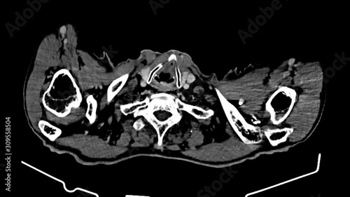 Human MRI Scan,  X-ray  - XRay Magnetic Resonance imaging , Ultra HD 4k