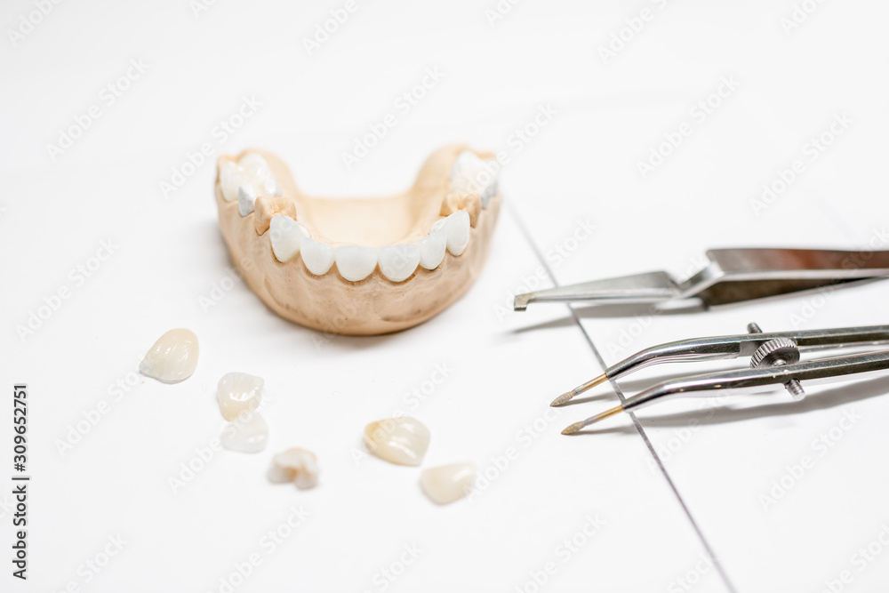 Artificial plaster jaw model with veneers and dental instruments on the white background. Concept of aesthetic dentistry and implantation technology Artificial plaster jaw model with veneers and dental instruments on the white background. Concept of aesthetic dentistry and implantation technology
