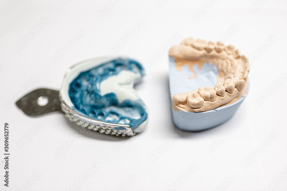 Artificial plaster jaw model with impression on the white background. Manufacture of molds for dentures in laboratory Artificial plaster jaw model with impression on the white background. Manufacture of molds for dentures in laboratory