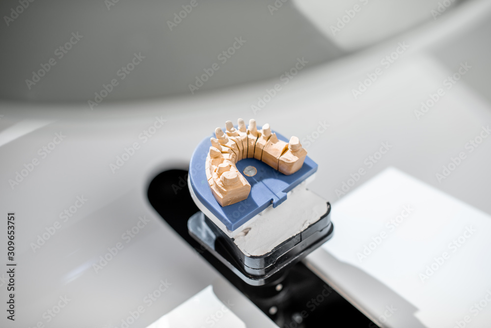 Scanning jaw model on the 3rd scanner in the laboratory, for the manufacture of dentures or implants, close-up Scanning jaw model on the 3rd scanner in the laboratory, for the manufacture of dentures or implants, close-up