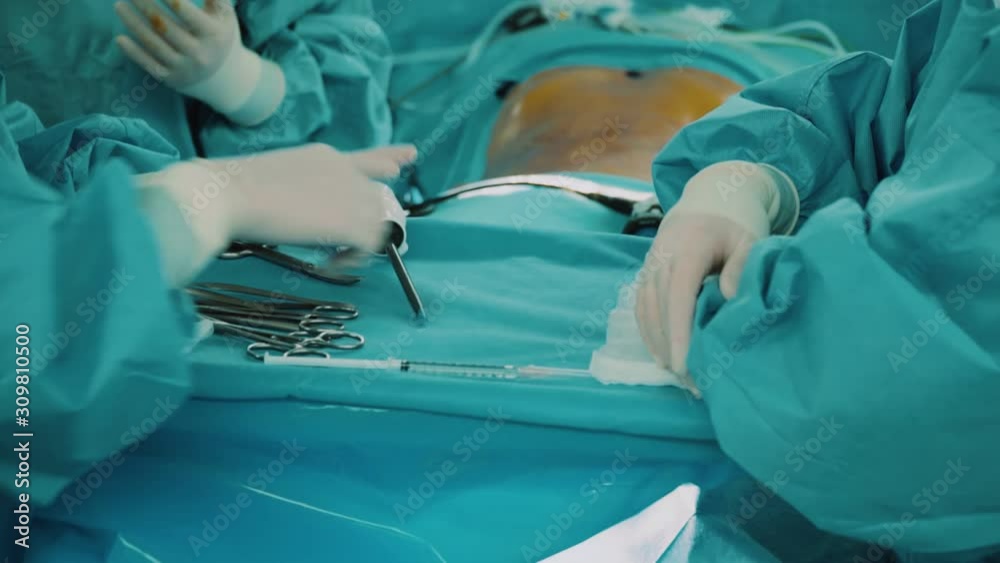 Preparation by assistants of medical tools on the table Preparation by assistants of medical tools on the table