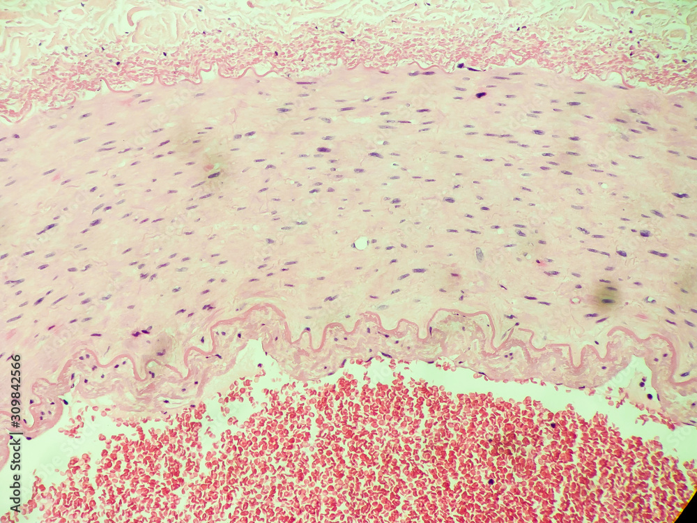 Blood Tissue Slide Labeled