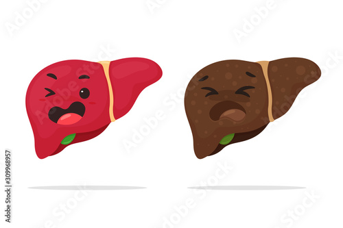 Liver vector. Fatty liver and cirrhosis caused by drinking alcohol. Isolated on a white background.