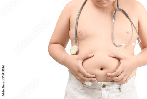 Obese fat boy with stethoscope isolated on white background