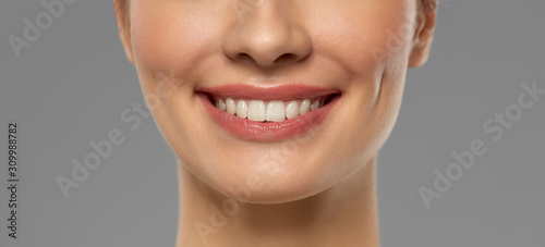 beauty, dental care and teeth whitening concept - close up of beautiful young woman with white smile over grey background