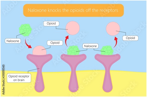Naloxone medicine used to block the effects of opioids medication