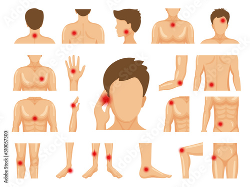 Body pain. Physical injury human trauma symbols on legs shoulders hands pain dots vector set. Pain leg, elbow or shoulder and knee illustration