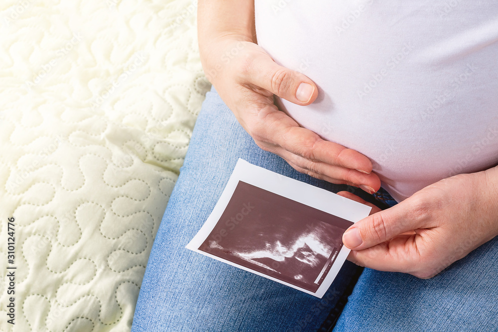 Pregnant woman sitting on bed. One hand hugs her tummy and in other holds ultrasound photo of future baby. Pregnancy concept. Third trimester. Babys face is clearly visible. Pregnant woman sitting on bed. One hand hugs her tummy and in other holds ultrasound photo of future baby. Pregnancy concept. Third trimester. Babys face is clearly visible.
