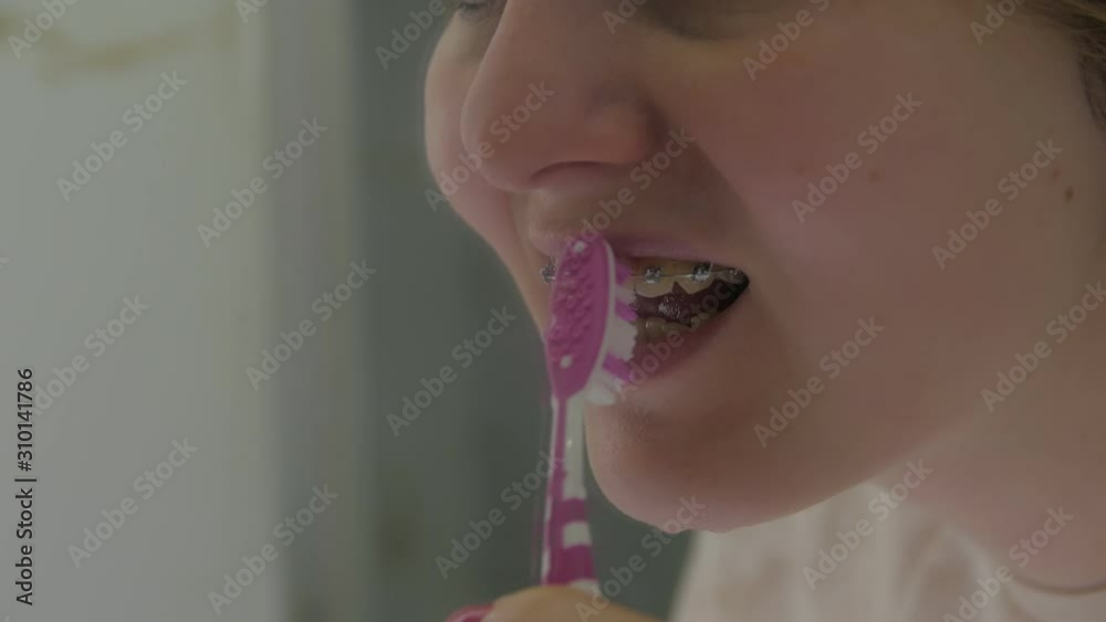 Girl brushing braces looks in mirror bathroom young woman cleans teeth closeup Girl brushing braces looks in mirror bathroom young woman cleans teeth closeup