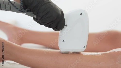 laser hair removal close up photo