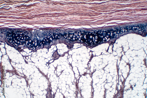 Obraz na plátně Human hyaline cartilage bone under microscope view for education pathology