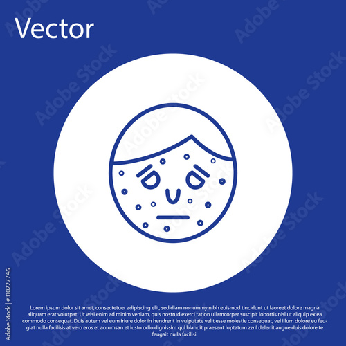 Blue line Face with psoriasis or eczema icon isolated on blue background. Concept of human skin response to allergen or chronic body problem. White circle button. Vector Illustration